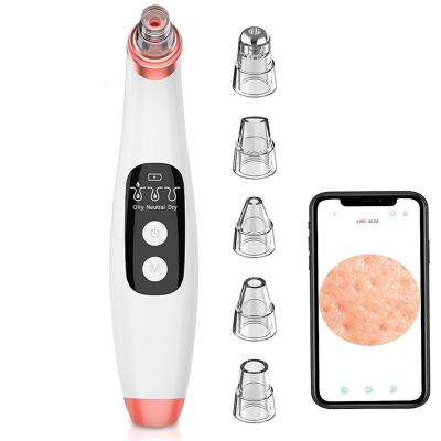 China WIFI Blackhead Removal Vacuum Nose Pore Remover Vacuum Comedone Acne Pimple Extractor Tool Vacuum Blackhead Remover Obvious Blackhead Remover for sale