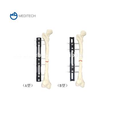 China Economic Custom Orthopedic Bone Lengthening External Fixator MED-123-1/2 for sale