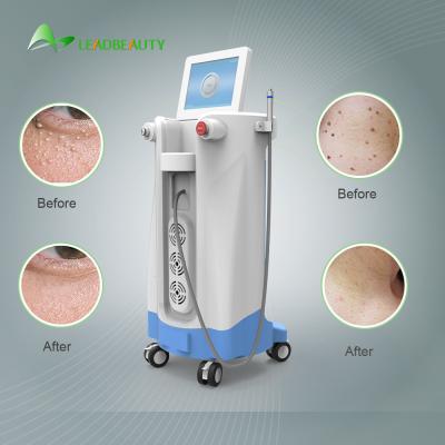 China For Blood Spider clearance 980nm Diode Laser Spider Vein Removal Machine for sale