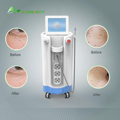 China For Blood Spider clearance Diode Laser Spider Vein Removal Machine 980nm for sale