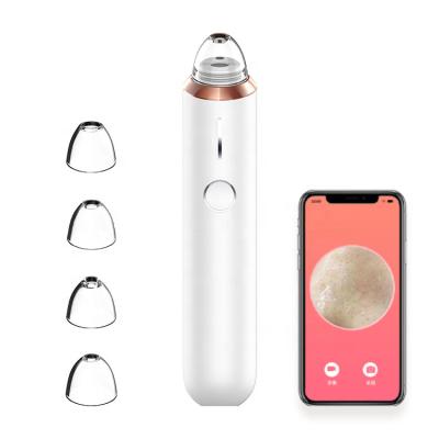 China Acne Treatment WIFI HD Visual Pore Vacuum Suction Blackhead Obvious Remover With Camera for sale