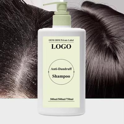 China Control de aceite Anti caspa Anti picazón Shampoo de limpieza profunda Shampoo para el cabello en venta