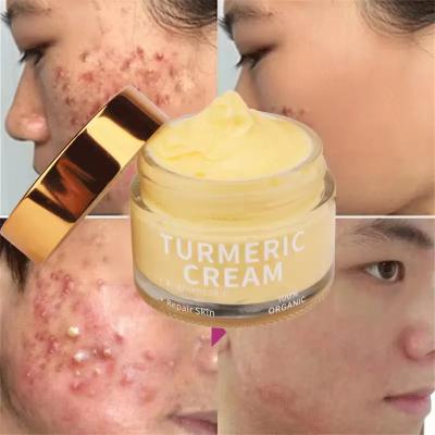 China Cuidado de la piel orgánico Acné Rugas Manchas oscuras Hidratante Blanqueador Cúrcuma Crema facial en venta