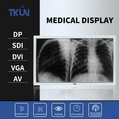 China TKUN 23.8/27 Inch High-definition Medical Display Surgical Display Can be Customized SDI Multiple Interfaces 4K Monitor for sale