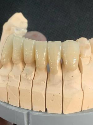 Cina Blocchetto dentario dentario traslucido di biossido di zirconio dello spazio in bianco 3D di biossido di zirconio dell'OEM pro in vendita