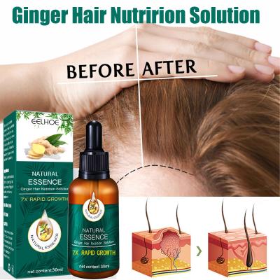 China Ginger Hair Growth Essence Germinal Hair Growth Serum Essence Oil Hair Loss Treatment Growth Hair for Men Women for sale