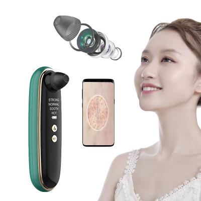 China Chinese Acne Treatment Big Brand OEM Blackhead Removal With Visible Function Connect To Phone APP for sale