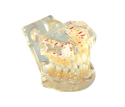 China Completely Transparent Alternating Model Teaching Model Of Primary And Permanent Teeth for sale