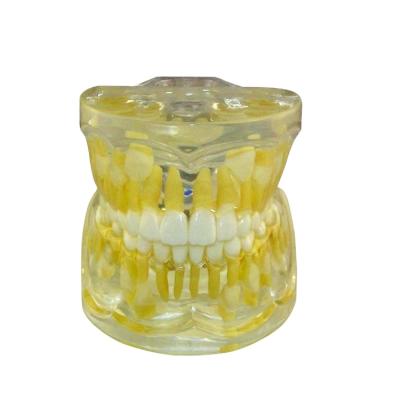 China Standard teaching model pediatric teeth dentition mix model dental model for 3 years old children for sale