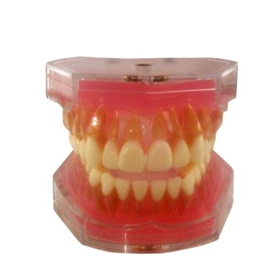 China Dental demonstration tooth extraction model with soft gum and removable teeth for sale