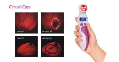 China Women Portable Infrared Breast Cancer Test At Home For Detecting Breast Cancer for sale