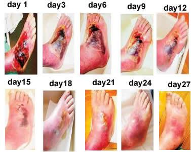 China Dispositivo de la gestión del dolor de cáncer de la terapia física/dispositivo electromágnetico de la terapia para la gestión del dolor de cáncer en venta