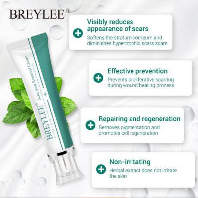 China Hot Selling Acne Treatment Acne Scar Removal Cream Visibly Reduces Scars Acne Removal Old Deep Stretch Cream for sale