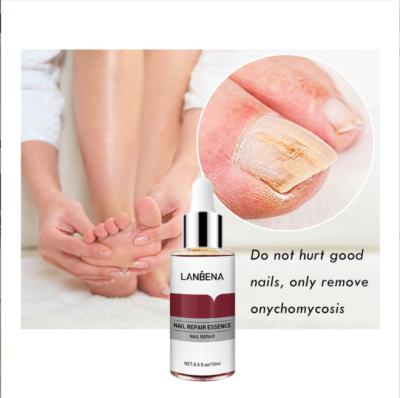 China Private Treatment Pen Toenail Fungus Treatment Rep de Logo Anti Fungal Treatment Nail Pen Strength Solution Onychomycosis Foot Infection for sale