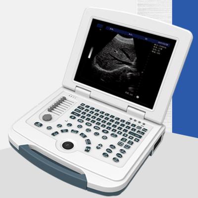 China China mais barato médico portátil full digital color doppler b ultra-som scanner/scan/máquina preço para a gravidez com p à venda