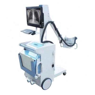 China Amazon Hot Sale New Low Energy Radiation China Digital X-Ray Metal Mobile 100mA X-ray Machine With Digital Flat Screen For Human for sale