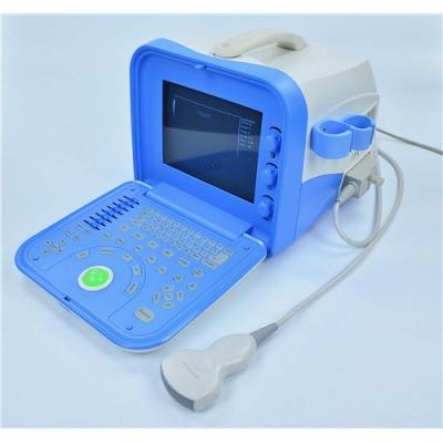 Chine Équipement de diagnostic par ultrasons numérique portable à vendre