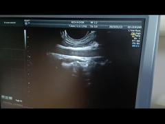 GE RIC5-9-D PROBE