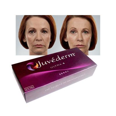 中国 Ultra3 Juvederm ヒアルロン酸皮膚フィラー 20mg/Ml リップ強化フィラー 販売のため