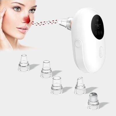 China Blackhead Remover Facial Pore Vacuum Blackhead Remover Remover Byebye Blackhead Suction Face Blackhead Remover Machine Facial Blackhead Remover Tool Kit for sale