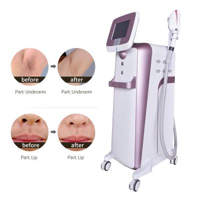 China Hot Selling Painless Permanent Dye Removal Laser Tattoo Removal Device DPL Skin Rejuvenation Best Pro Machine For Female for sale