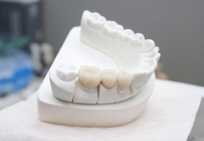 China Aleación dental del metal bajo del Co-Cr en venta