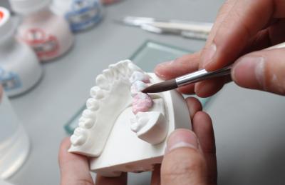 China El metal bajo dental de la astilla alea la prótesis desprendible para el sistema abierto de la leva del cad en venta