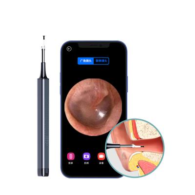 China Ultra-Fast Endoscope Wifi Camera Chip 3.5mm 1080 Hd Ear Scoop Ear Endoscope Ear Wax Removal Remover for sale