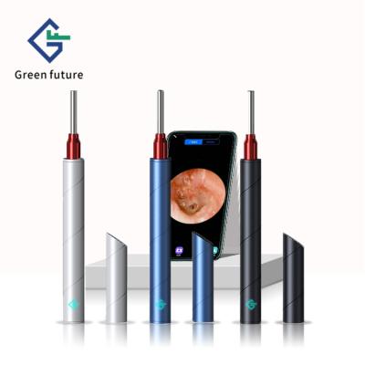 China Magnet Cover Switch Micro USB Endoscope Android Wifi Otoscope Ear Canal Checking Ear Cleaner for sale