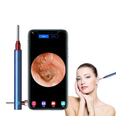 China Magnet Cover Switch OEM High Resolution Visual Wireless Endoscope Ear Wax Remover Ear Wax Remover Clean Tool for sale