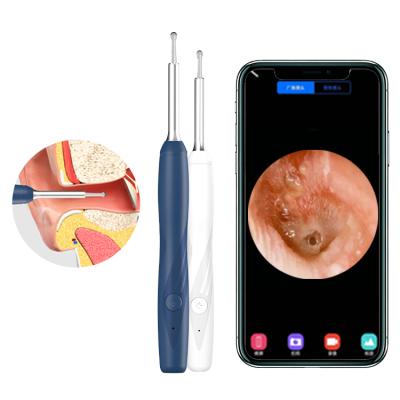 China Ear Cleaner New Model Hd Ear Otoscope Ear Tool Earwax Cleaner Cleaner With Spare Scoops for sale