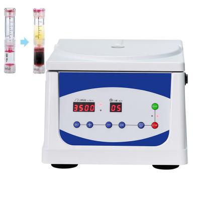 Cina 5ml 10ml 15ml Small Size Benchtop Centrifuge For Laboratory and Blood Seperation in vendita