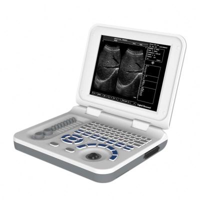 China HBW-3 Full Digital Metal Laptop B/W Ultrasound Machine for sale