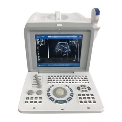 China Digital B/W Ultra Hospital Medical Sound Equipment Full Portable Ultrasound Machine for sale