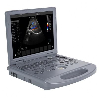 China Portable Hospital Ultrasound Laptop 3D Color Doppler Ultrasound Machine for sale