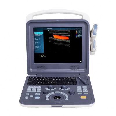 China Portable Metal Medical Equipment SonoScape Ultrasound Machine Color Doppler Ultrasound System for sale