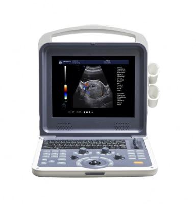 China Portable Metal SonoScape Medical Ultrasound Machine 4D 12 Inch LED Color Doppler System for sale