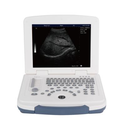 China Metal most economic black and white ultrasound CD-580 for sale