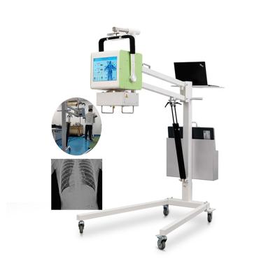 China Lightweight Medical Digital X Ray Machine Cr Dr System Rayos X 5kw Portable X Ray Machine for sale