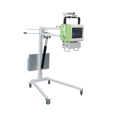 China X-ray room. X-ray service | 5kw DR Human X-Ray Equipment Price Chest X Ray Equipments Digital Portable Medical High Frequency X-ray Machine for sale