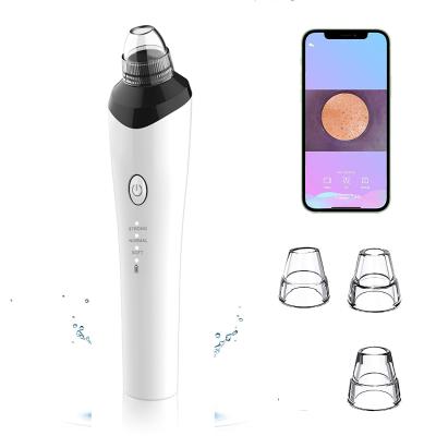 China WIFI HD Blackhead Obvious Blackhead Remover Vacuum Acne Blackhead Treatment Visual Suction Removal With Camera for sale