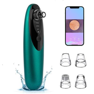 China Goodbye Electric Acne Pore Remover Electric Pore Acne Treatment Blackhead Remover Vacuum Cleaner With Camera for sale