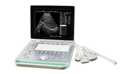 China SV-7 15 inches CE Approved laptop PC based ultrasound scanner with four probes for sale