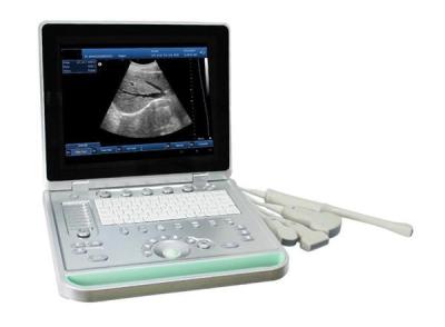 China SV-9 PC Based 3D Laptop Ultrasound scanner with one 3.5 Mhz convex probe for sale