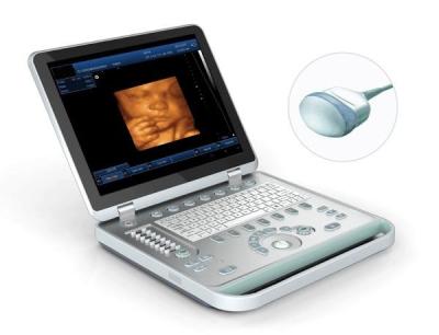 China SV-10Plus CE Approved 4D Laptop Ultrasound Scanner with one 4D probe for sale