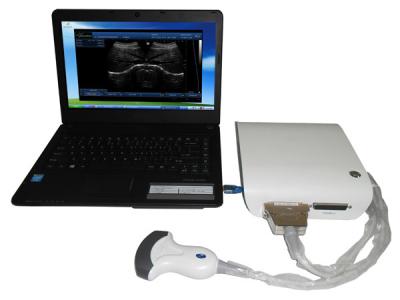 China SV-U10 Black and White Ultrasound Software Box,PC Ultrasound Software with one convex probe for sale