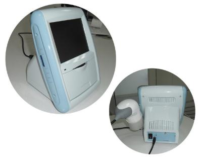 China M1210 Portable ultrasound bladder scanner  With one A probe , a 3D Mechanical scan probe and  internal printer. for sale