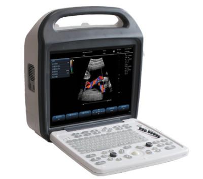 China SV-1000 Portable Color Doppler Ultrasound Systemwith one convex probe for sale