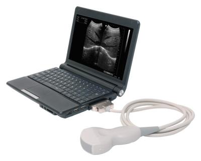 China SV-U7 10.1 inches Black Mini Laptop Ultrasound Scanner with three Probes for sale