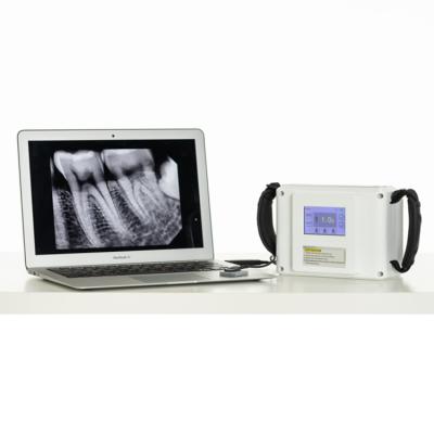 China X-ray room. X-ray service | Touth-LCD Screen Dental X-Ray Unit High Frequency Portable Dental X-Ray Camera for sale